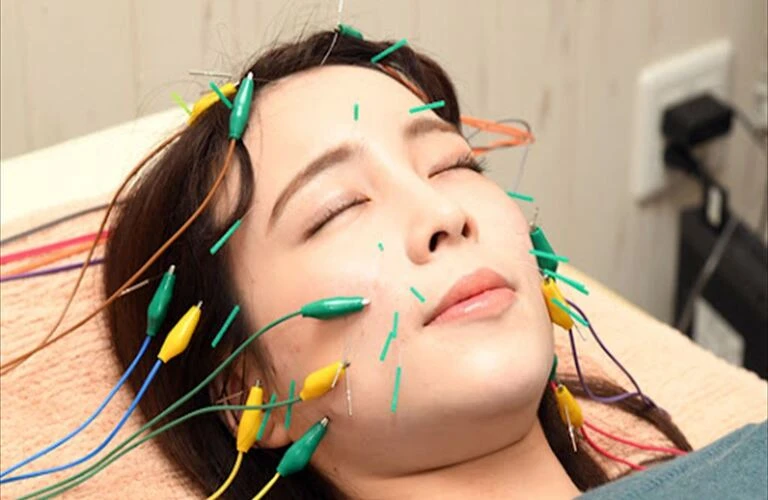 JMCAA認定の安心と信頼！北久里浜で実現する美しさと健康のためのリフトアップ美容鍼