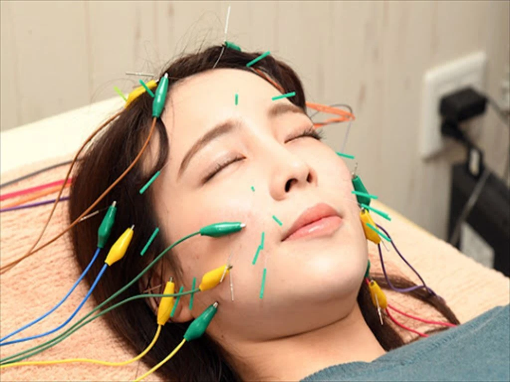 JMCAA認定の安心と信頼！北久里浜で実現する美しさと健康のためのリフトアップ美容鍼