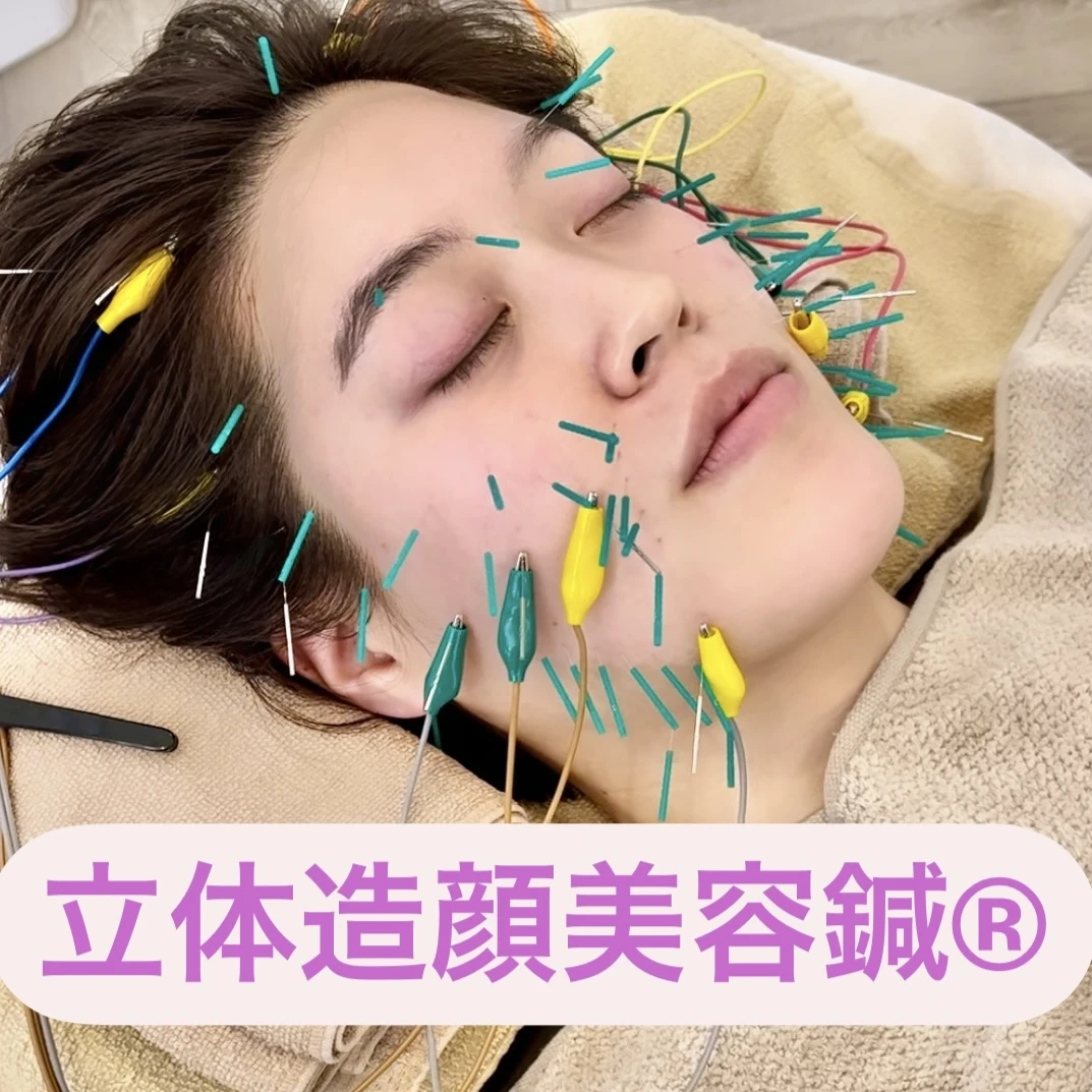 立体造顔美容鍼の効果