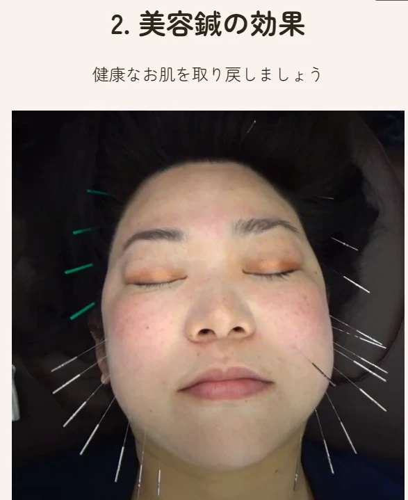 リフトアップの効果を実感