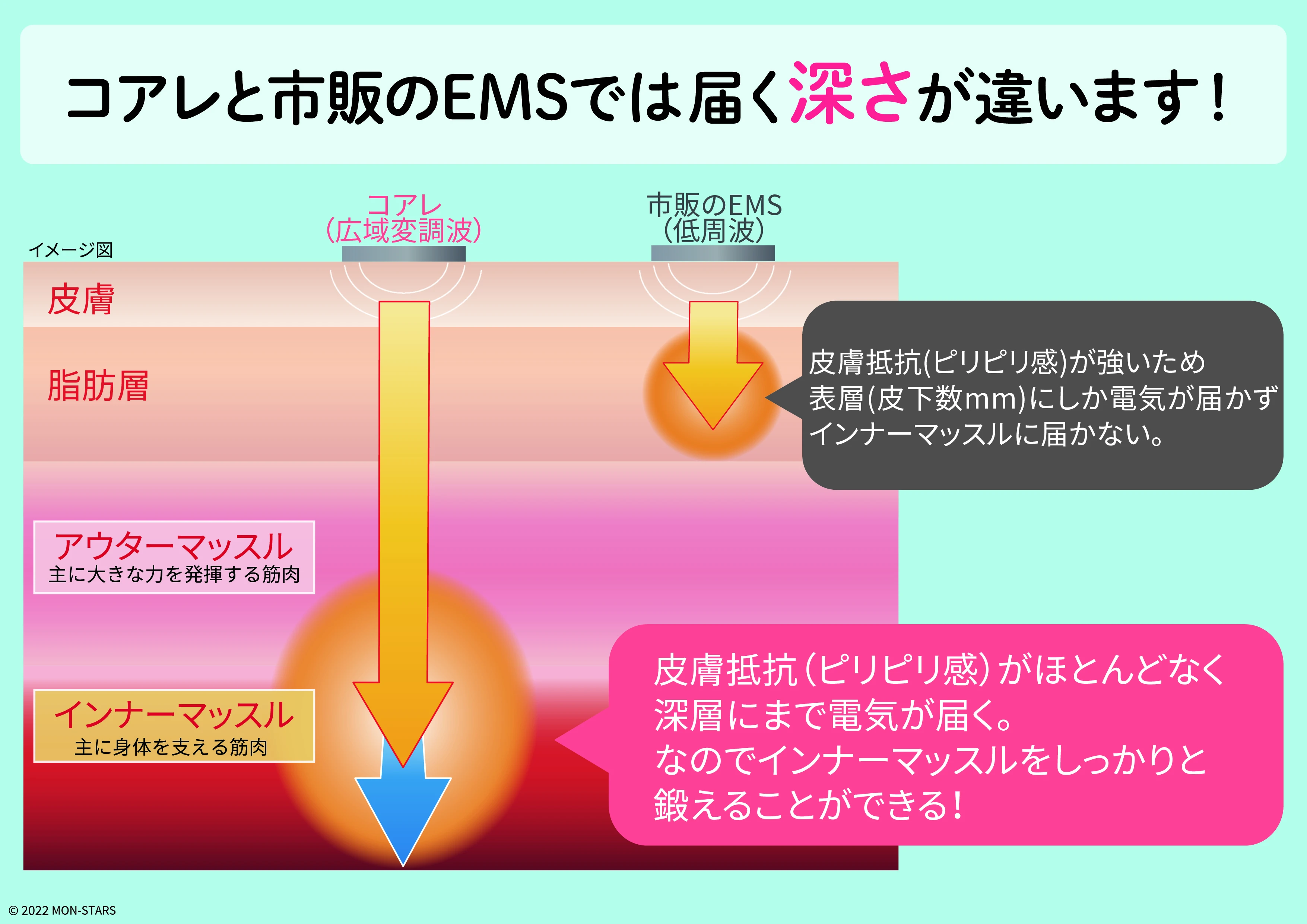 コアレ施術の流れ