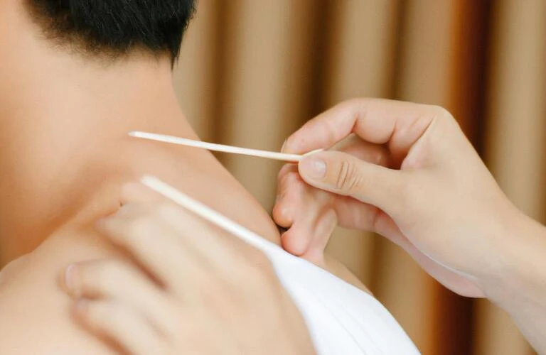 肩こりからの解放を、鍼灸整体で実現！