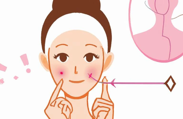 ほうれい線を気にせず、北久里浜の美容鍼で美しい肌を手に入れよう！
